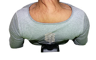 spine aligner position detail xray